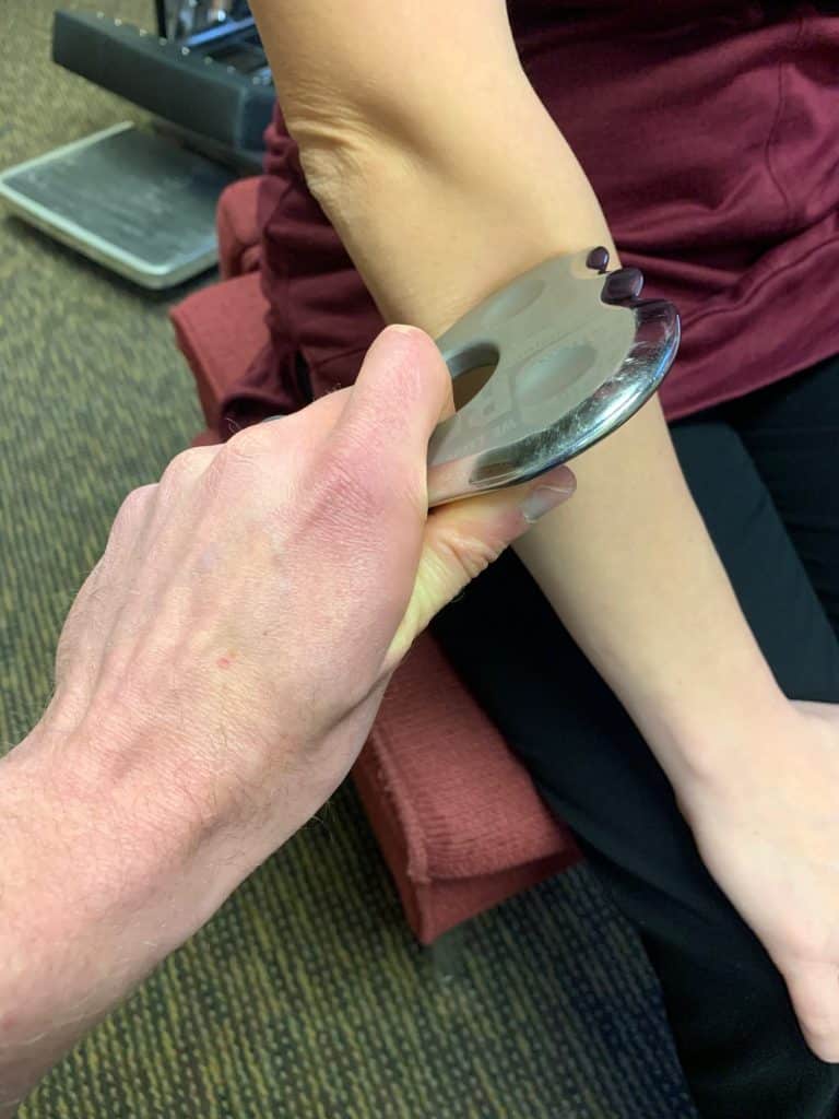 myofascial release performed on a tennis elbow patient