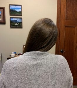 torticollis caused this patient's neck to be stuck to the side